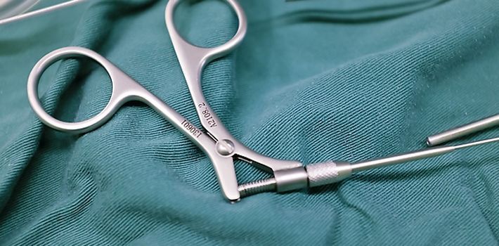 意大利女子体内发现一把手术钳 竟是医生手术时不慎遗留